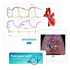 Scenes from inside heart sounds. Various heart illustrations and ecg charts