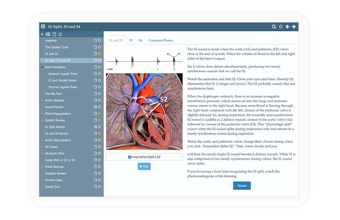 heart sounds product showing diagram on tablet