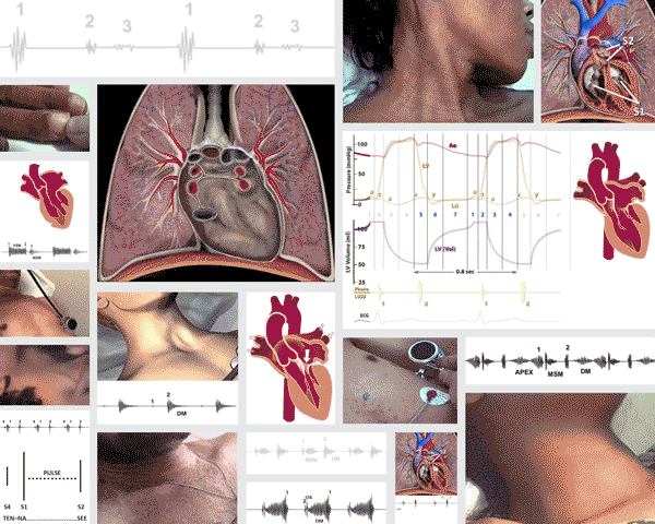 Cardiac anatomy animations and sound animations from heart sounds