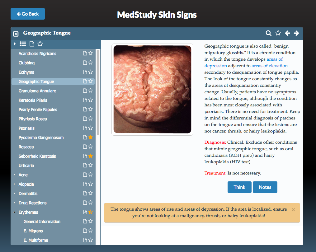 Image of geographic tongue with written description