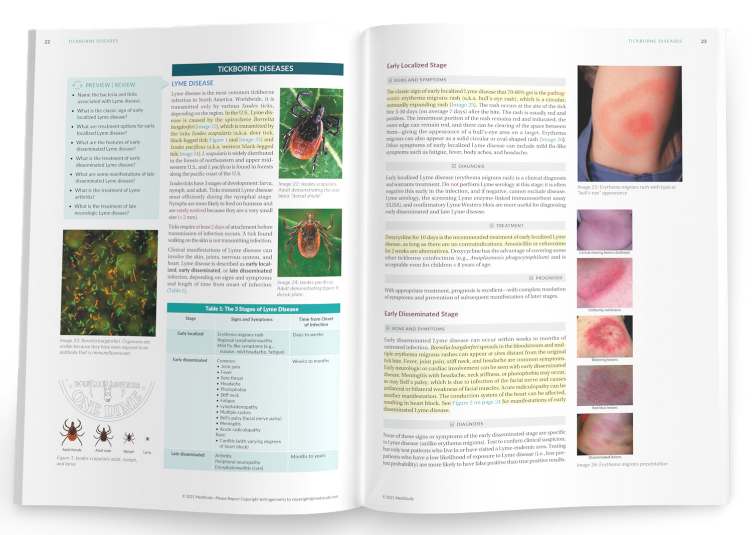 A Medical Student core book is open to a two-page spread showing content from the Tickborne Diseases topic