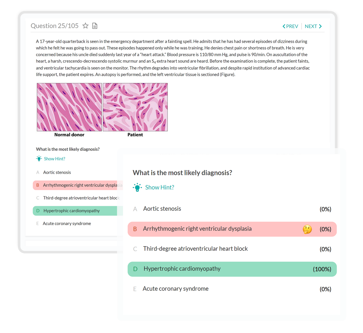 student qbank plus peer comparison showing percentage of people who selected the answers on tablet device