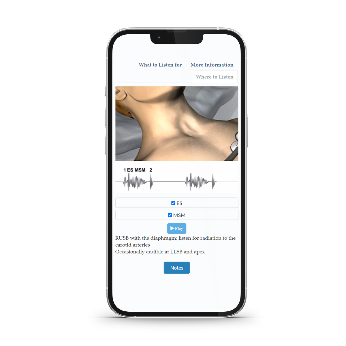 Heart Sounds | MedStudy