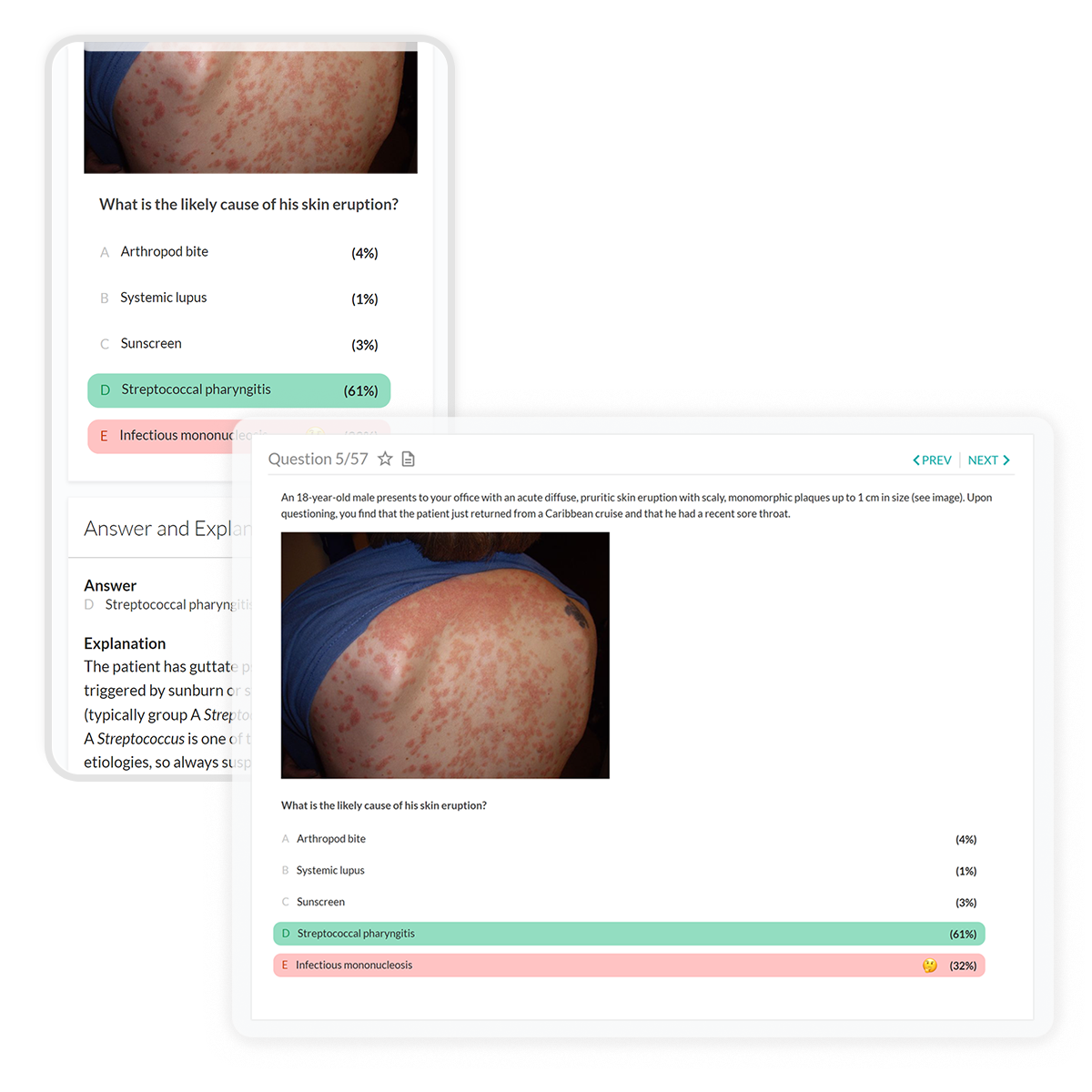 internal medicine q and a's with incorrect question selected on tablet and mobile devices